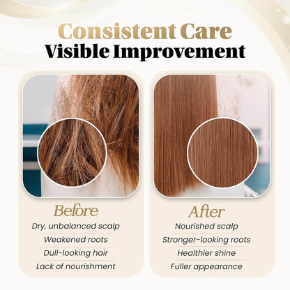 Zova Hair Growth Balm